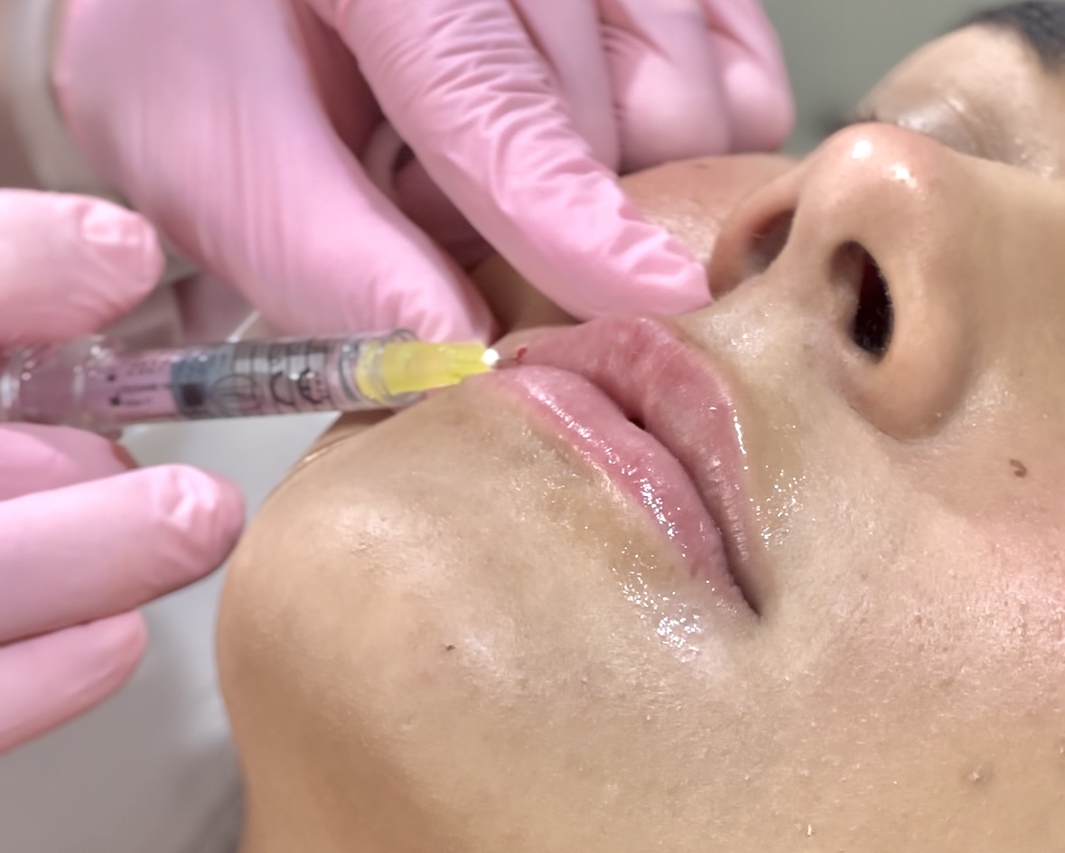 Marce Bienestar Medicina Estética
