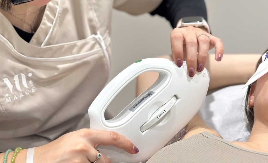 Depilación IPL Centro de Bienestar Marce